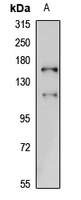 DGK delta Rabbit Polyclonal Antibody