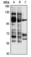 DGK theta Rabbit Polyclonal Antibody