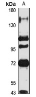 DIS3 Rabbit Polyclonal Antibody