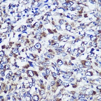 Anti-DIS3L Antibody