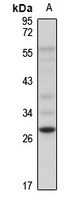 DKK1 Rabbit Polyclonal Antibody