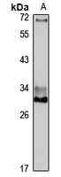 DKK2 Antibody