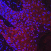 Anti-DKK2 Antibody