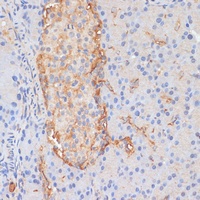 Anti-DLL1 Antibody