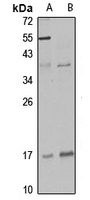 DLX6 Antibody
