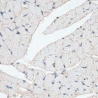 Dystrophin antibody