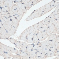 Dystrophin Rabbit Polyclonal Antibody