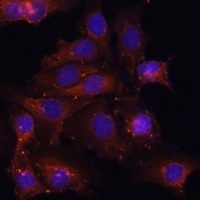 Dystrophin Rabbit Polyclonal Antibody