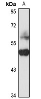 Dermokine Rabbit Polyclonal Antibody