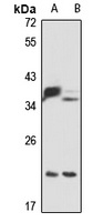 DNAJC12 Antibody