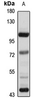 DPP6 Rabbit Polyclonal Antibody