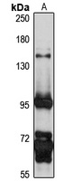 DPRP2 Rabbit Polyclonal Antibody
