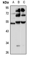 Dopamine Receptor D2 Rabbit Polyclonal Antibody