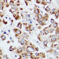 dUTPase antibody