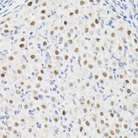 Anti-DYNLL1 Antibody