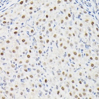 DYNLL1 antibody