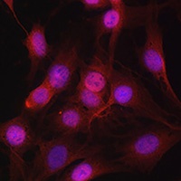 Anti-DYNLL1 Antibody