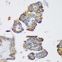 DNLC2A Rabbit Polyclonal Antibody