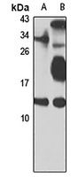 TCTEX-1 Rabbit Polyclonal Antibody