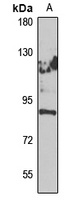 ECE2 Rabbit Polyclonal Antibody