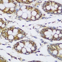 Anti-ECH1 Antibody