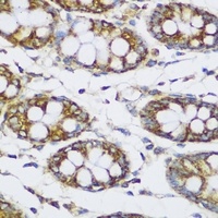 ECH1 antibody