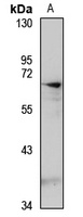 ECM1 Rabbit Polyclonal Antibody
