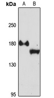 EDC4 Antibody
