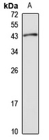 ET-3 Rabbit Polyclonal Antibody