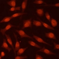 Anti-EED Antibody