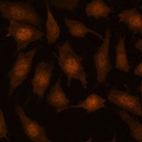 Anti-EEF1E1 Antibody