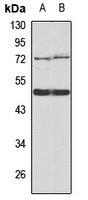 EGLN1/2 Antibody