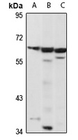 EGR-1 Rabbit Polyclonal Antibody