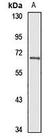eIF2 alpha Rabbit Polyclonal Antibody