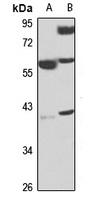 EIF2B Antibody