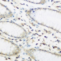 Anti-EIF2B Antibody