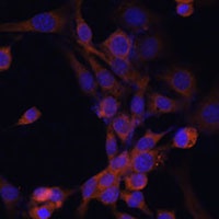 Anti-EIF2B Antibody