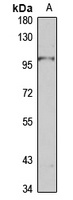 HPC2 Rabbit Polyclonal Antibody