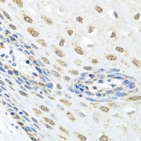 HPC2 Rabbit Polyclonal Antibody