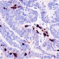 Neutrophil Elastase antibody