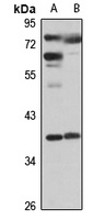 ELOVL2 Rabbit Polyclonal Antibody