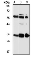 EML1 Rabbit Polyclonal Antibody