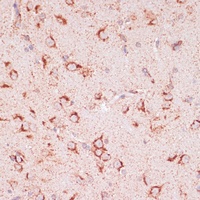 Anti-CD39L2 Antibody