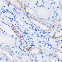 Anti-EPN1 Antibody