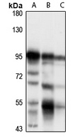 EPS8 Rabbit Polyclonal Antibody