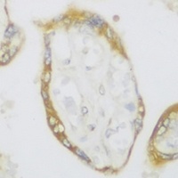 Anti-SPFH1 Antibody