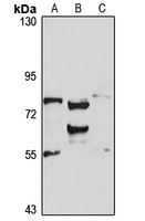RBM35A Rabbit Polyclonal Antibody