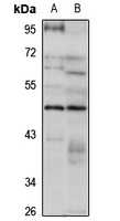 ERR beta Antibody