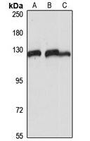 ESYT1 Antibody