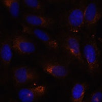 Anti-ESYT1 Antibody